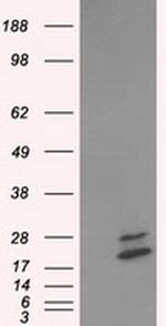 NME4 Antibody in Western Blot (WB)