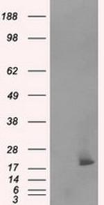 NME4 Antibody in Western Blot (WB)