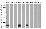 NME4 Antibody in Western Blot (WB)