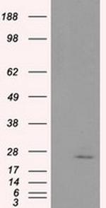 NME4 Antibody in Western Blot (WB)