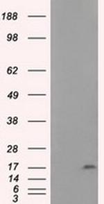 NME4 Antibody in Western Blot (WB)