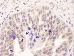 NMI Antibody in Immunohistochemistry (IHC)