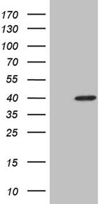 NMI Antibody in Western Blot (WB)