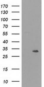 NMNAT1 Antibody in Western Blot (WB)