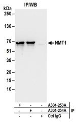 NMT1 Antibody in Western Blot (WB)