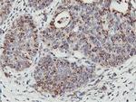 NMT2 Antibody in Immunohistochemistry (Paraffin) (IHC (P))