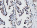 NMT2 Antibody in Immunohistochemistry (Paraffin) (IHC (P))