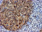 NNMT Antibody in Immunohistochemistry (Paraffin) (IHC (P))