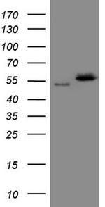 NOB1 Antibody in Western Blot (WB)