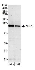 NOL1 Antibody in Western Blot (WB)
