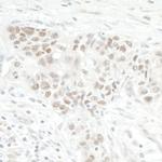 NOL12 Antibody in Immunohistochemistry (IHC)