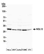 NOL12 Antibody in Western Blot (WB)