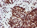 NONO Antibody in Immunohistochemistry (Paraffin) (IHC (P))