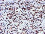 NONO Antibody in Immunohistochemistry (Paraffin) (IHC (P))