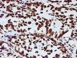 NONO Antibody in Immunohistochemistry (Paraffin) (IHC (P))