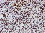 NONO Antibody in Immunohistochemistry (Paraffin) (IHC (P))