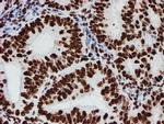 NONO Antibody in Immunohistochemistry (Paraffin) (IHC (P))