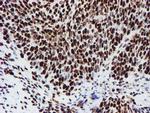 NONO Antibody in Immunohistochemistry (Paraffin) (IHC (P))