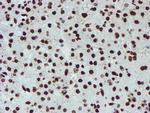 NONO Antibody in Immunohistochemistry (Paraffin) (IHC (P))