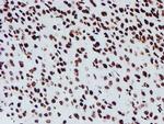 NONO Antibody in Immunohistochemistry (Paraffin) (IHC (P))