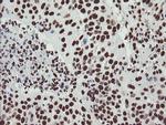 NONO Antibody in Immunohistochemistry (Paraffin) (IHC (P))