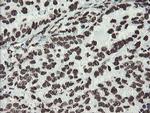 NONO Antibody in Immunohistochemistry (Paraffin) (IHC (P))