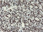 NONO Antibody in Immunohistochemistry (Paraffin) (IHC (P))