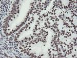 NONO Antibody in Immunohistochemistry (Paraffin) (IHC (P))