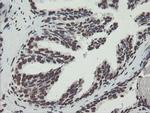 NONO Antibody in Immunohistochemistry (Paraffin) (IHC (P))