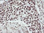 NONO Antibody in Immunohistochemistry (Paraffin) (IHC (P))