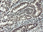 NONO Antibody in Immunohistochemistry (Paraffin) (IHC (P))