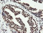 NONO Antibody in Immunohistochemistry (Paraffin) (IHC (P))