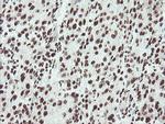 NONO Antibody in Immunohistochemistry (Paraffin) (IHC (P))