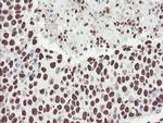 NONO Antibody in Immunohistochemistry (Paraffin) (IHC (P))