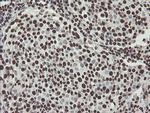 NONO Antibody in Immunohistochemistry (Paraffin) (IHC (P))