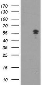 NONO Antibody in Western Blot (WB)