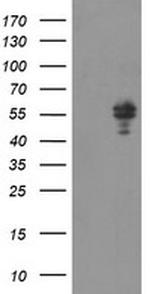 NONO Antibody in Western Blot (WB)