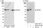 NOP58 Antibody in Western Blot (WB)