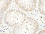 NOPP140 Antibody in Immunohistochemistry (IHC)