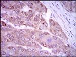 iNOS Antibody in Immunohistochemistry (Paraffin) (IHC (P))