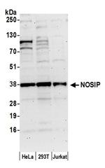 NOSIP Antibody in Western Blot (WB)