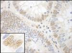 NPAT Antibody in Immunohistochemistry (IHC)