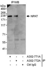 NPAT Antibody in Immunoprecipitation (IP)