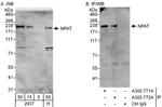 NPAT Antibody in Western Blot (WB)