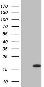 NPPB Antibody in Western Blot (WB)