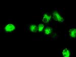 NPR3 Antibody in Immunocytochemistry (ICC/IF)