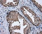 NPR3 Antibody in Immunohistochemistry (Paraffin) (IHC (P))