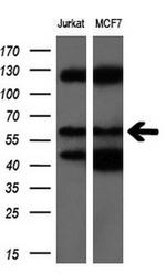 NPR3 Antibody in Western Blot (WB)