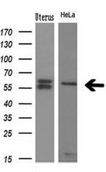 NPR3 Antibody in Western Blot (WB)