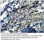 Natriuretic Peptide Receptor C Antibody in Immunohistochemistry (IHC)